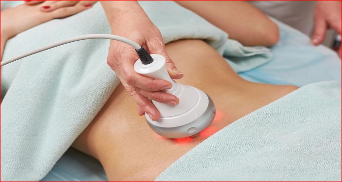 Fat Cavitation Gold Coast