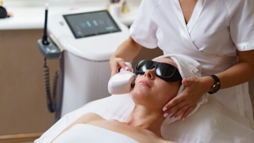 IPL photofacial